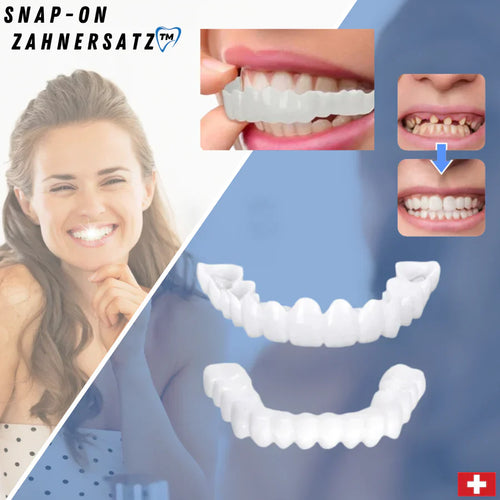 Lune London | SnapFit Dental Restoration | Always a Perfect Smile
