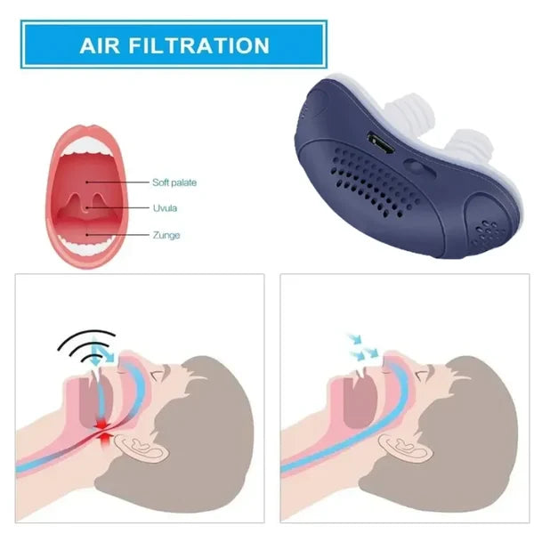 Lune London | Sleepless, mask-free, Micro-CPAP Anti-Snoring